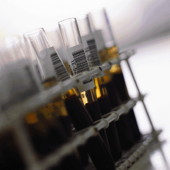 Image: High quality human clinical specimens for IVD development (Photo courtesy of Binding Site.)